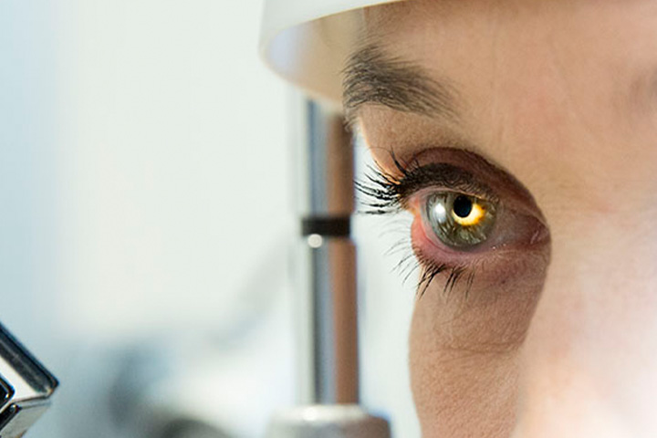 Augenkrankheiten Keratokonus Hornhaut Untersuchung